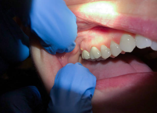  Bloomington, TX Emergency Dentist Pros